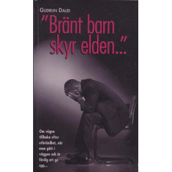 Bränt barn skyr elden